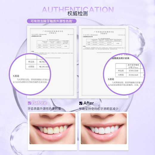 舒客【肖战同款】智感焕白牙膏全新高端美白牙齿 送男女生 生日礼物 【混合口味2支】兰花+茉莉 240g