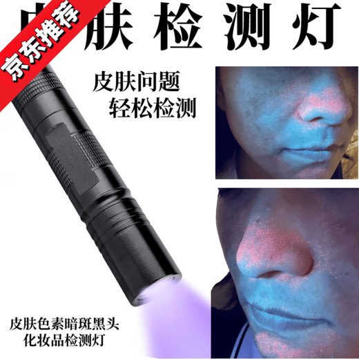 Skin detector, blackhead, acne and grease lamp, fungus and ringworm diagnosis, facial lighting, cosmetics, fluorescent flashlight, skin detection lamp, diamond-encrusted model, rechargeable model 20W