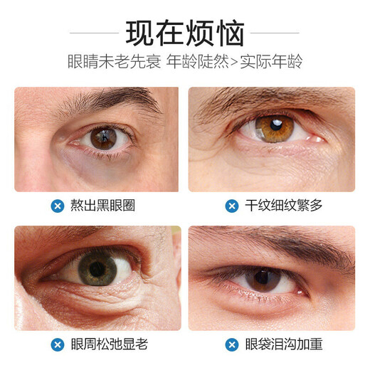 sakose凡士林六胜肽多效男士眼膜贴一盒装10对 淡化黑眼圈眼袋紧致抗皱