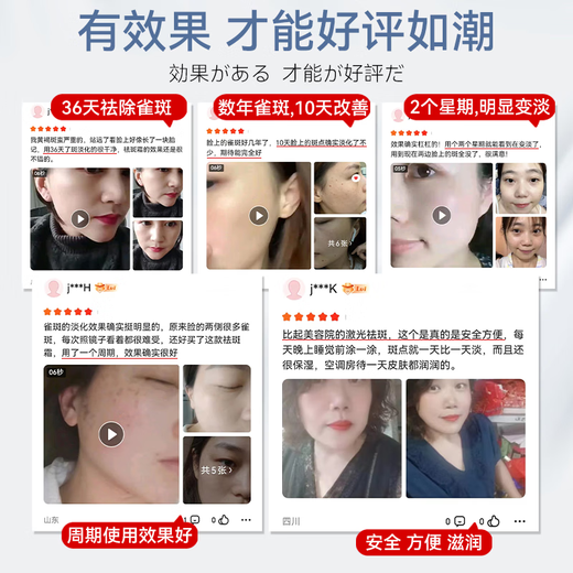 奈皙日本377烟酰胺美白祛斑霜淡化黑色素去雀斑老年黄褐斑面霜男女士