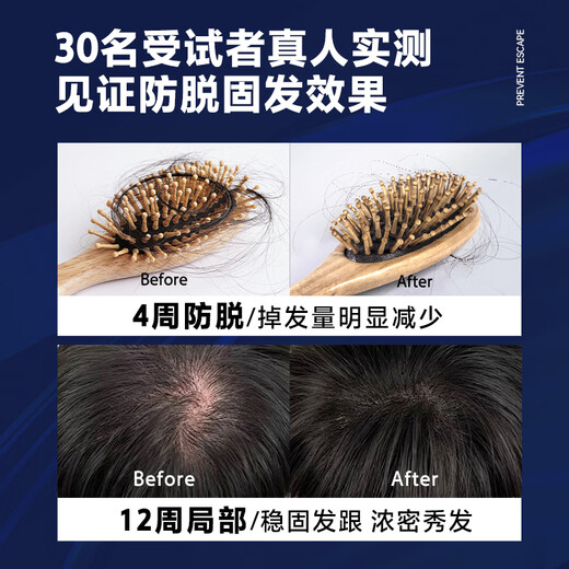 Ocean Supreme men's anti-hair loss and hair loss shampoo 300ml fluffy anti-dandruff oil control ginger anti-breakage hair loss shampoo for men and women