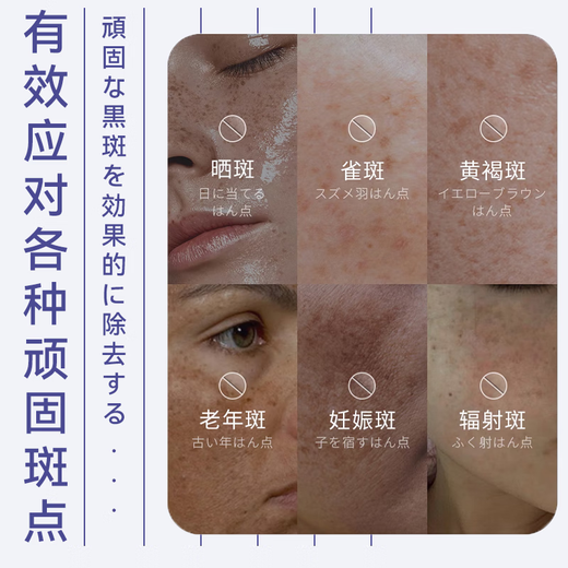 Naxi Japan 377 Niacinamide Whitening Cream Lightening Melanin Removal of Freckles, Melasma Sunscreen Cream Men and Women