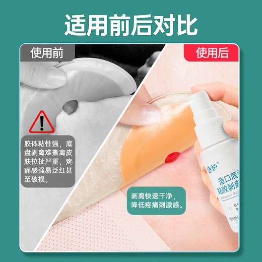 
Crafting stoma chassis viscose stripping spray quick glue removal agent medical glue removal agent alcohol-free Kanglebao12010 [1 bottle] 1702 chassis stripping agent