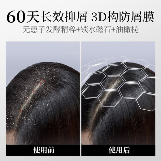 Ziyuan [Menziyi same style] 1% selenium disulfide anti-dandruff anti-itchi shampoo Blue Aurora men and women shampoo 215g