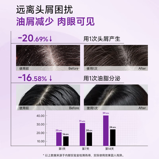 Hecaoji Selenium Disulfide Shampoo Anti-dandruff Anti-Itchy Men and Women's Hair Follicles Cleansing Oil Control Fluffy Washing Cream Purple Bottle