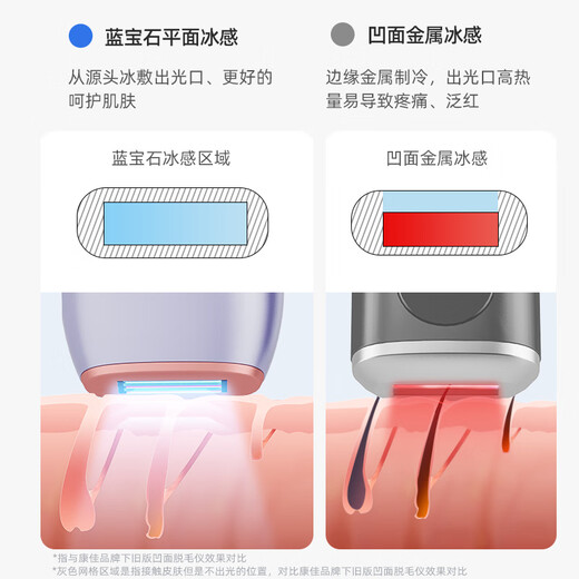 KONKA Hair Removal Device 3301 Sapphire Ice Feeling Freezing Point Home Dormitory Lip Armpit Large Leg Bikini Line Hair Removal Machine Artifact Practical Gift for Girlfriend’s Birthday Price Guaranteed Cream White-Ice Point Sapphire Pro Version