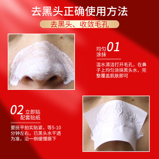 Garysoon Thai blackhead removal nose patch white aloe vera gel shrink set unisex pore blackhead water blackhead water + pore shrinking gel (T zone type) + stickers + gifts