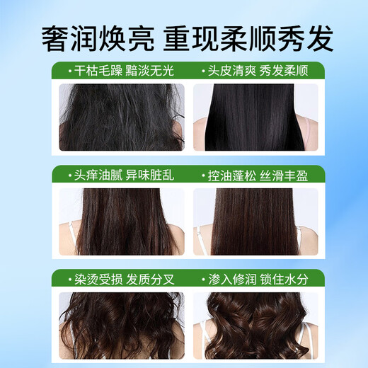 Cabello de 100 años Shampoo hidratante Hidratando a hombres sedosos y cuidado de la mujer Aminoácidos Champú Cabezo de cabello Centáñico Hidratante 750 ml