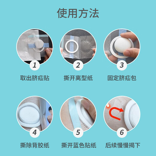 Care1st嘉卫士 婴儿疝气贴 脐疝贴 婴儿凸肚脐专用 压疝气肚脐贴20贴