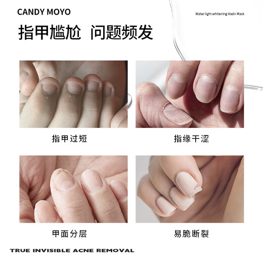 CandyMoyo Keratin Nail Care Liquid Finger Edge Nutritional Oil Strong Conservation Thin Brittle Soft Break Layered Nail Surface Extends Nail Bed 2ml