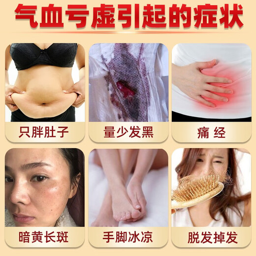 麦金利当归黄芪铁颗粒 补铁补血改善贫血 调月经虚胖缺铁贫血 补血颗粒 3盒  【周期滋补养颜】   麦金利当归黄芪颗粒