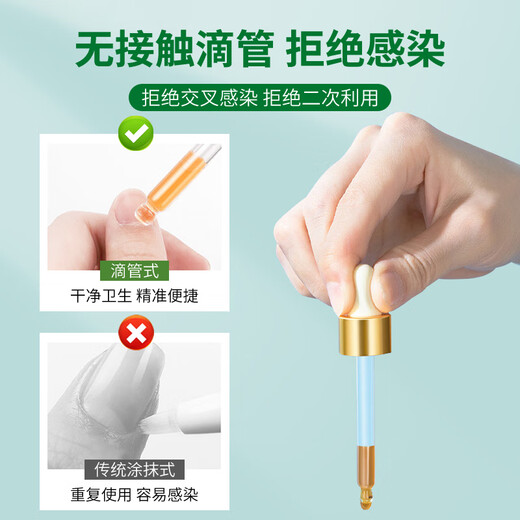 Correct onychomycosis antibacterial liquid, non-special effect, deck thickening and discoloration, nail groove fungal infection, impatiens sterilization and nail removal, 2 bottles of onychomycosis antibacterial liquid, moderate, no problem
