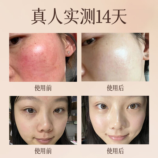 奈皙日本大马士革玫瑰纯露爽肤水补水保湿水女男士护肤湿敷精华水修复