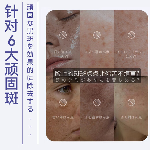 奈皙日本377烟酰胺美白祛斑霜淡化黑色素去雀斑老年黄褐斑面霜男女士
