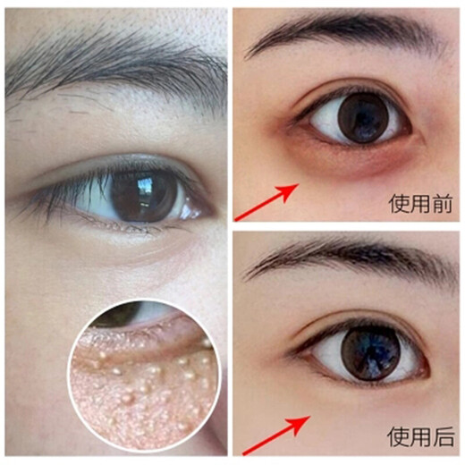 九叶草眼霜保湿补水提拉紧致抗眼纹眼部男女士精华30g