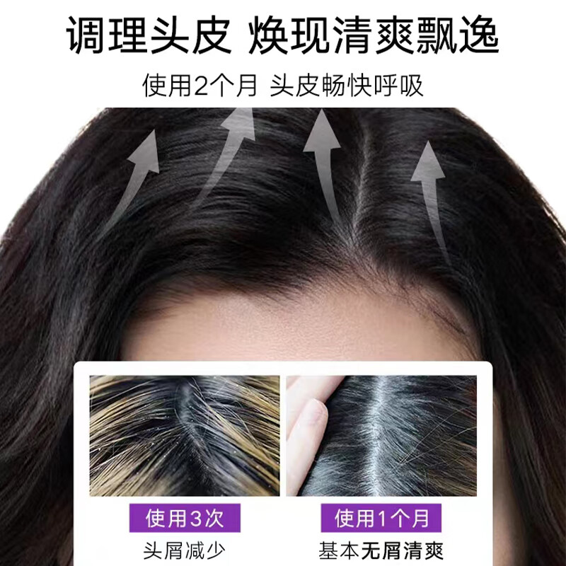 SHEVEU oil control purple bottle shampoo 375ml selenium disulfide anti-dandruff fluffy anti-itch Australian selsun new year product