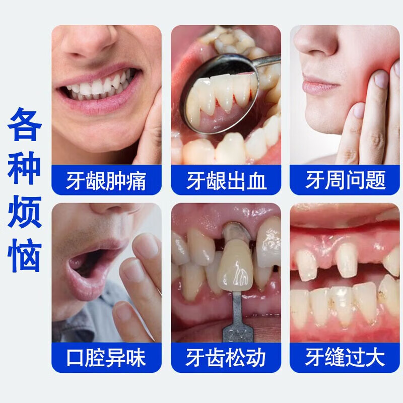 FUNCGGI Teeth Separating Agent Toothpaste, Preserves Bleeding Teeth, Loose Teeth, Toothache, Gum Swelling, Pain and Shrinkage Repair
