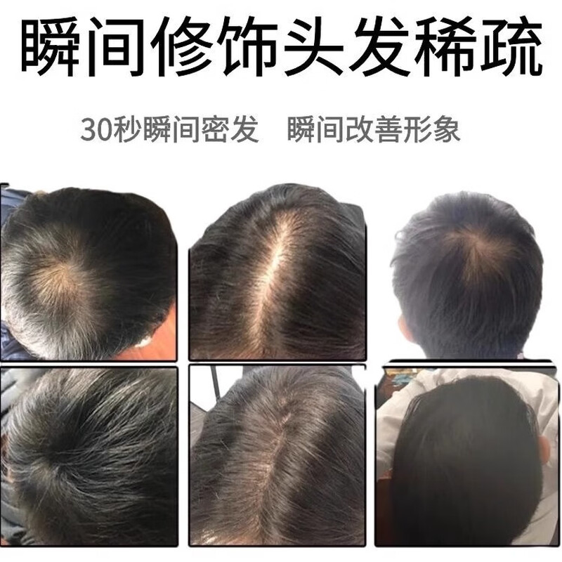 Xingfutang Hair Fiber Powder 25g Hairline Powder Covering Artifact Replenishing Powder for Thinning Top Hair