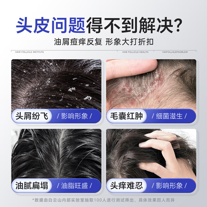 Baiyunshan selenium disulfide shampoo anti-dandruff, anti-itch, oil control, fluffy, refreshing, silicone-free shampoo for men and women 400ml