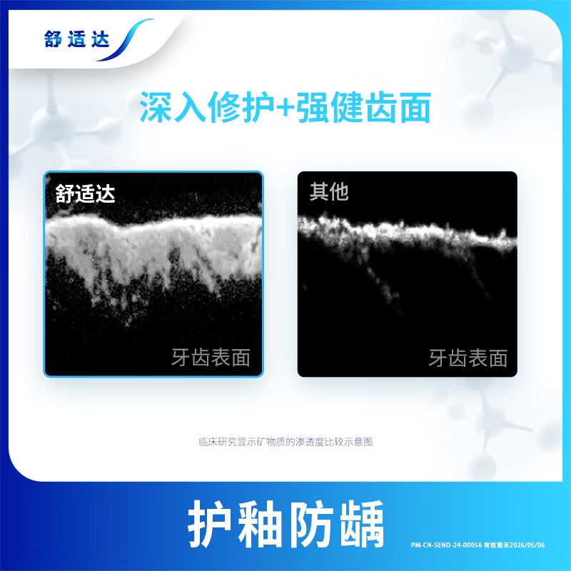 Sensodyne gum care toothpaste 180g contains fluoride, anti-allergic, anti-cavity and solid teeth. New and old packaging are sent randomly.