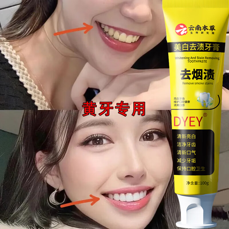 Dyey Yunnan Herbal Whitening and Stain Remover Toothpaste (Buy 2 Get 1 Free) Removes Tooth Stains, Removes Yellowing, Removes Smoke Stains, Brightens Oral Odor, 1 tube/100g