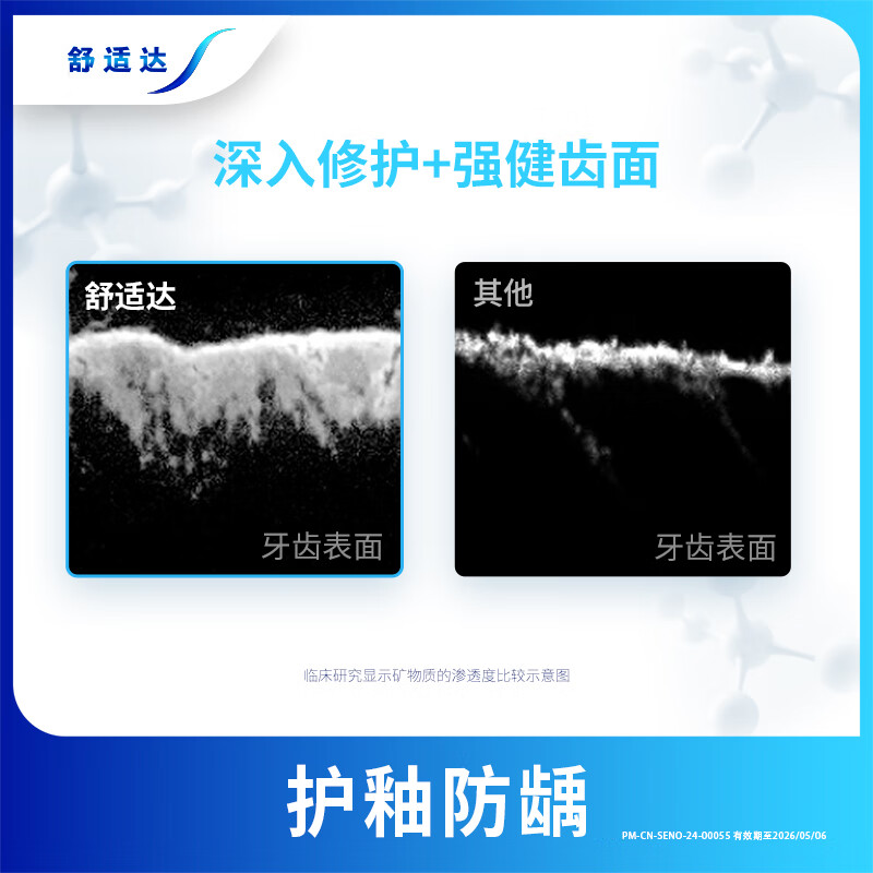 Sensodyne Speed Care Toothpaste 70g 60s fast anti-allergic, relieve sensitivity, anti-allergic and anti-moth, new and old packaging randomly sent