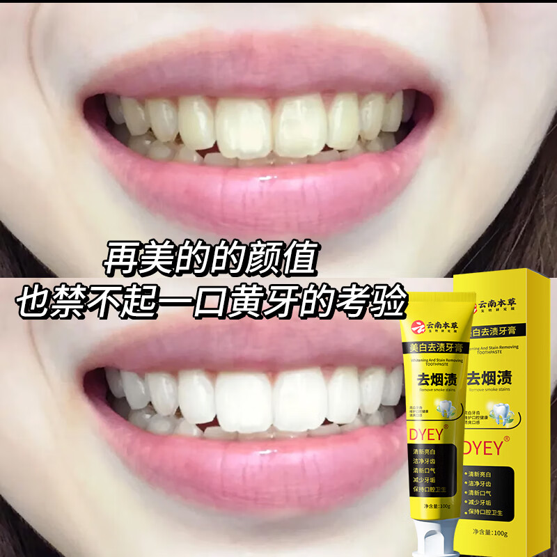 Dyey Yunnan Herbal Whitening and Stain Remover Toothpaste (Buy 2 Get 1 Free) Removes Tooth Stains, Removes Yellowing, Removes Smoke Stains, Brightens Oral Odor, 1 tube/100g