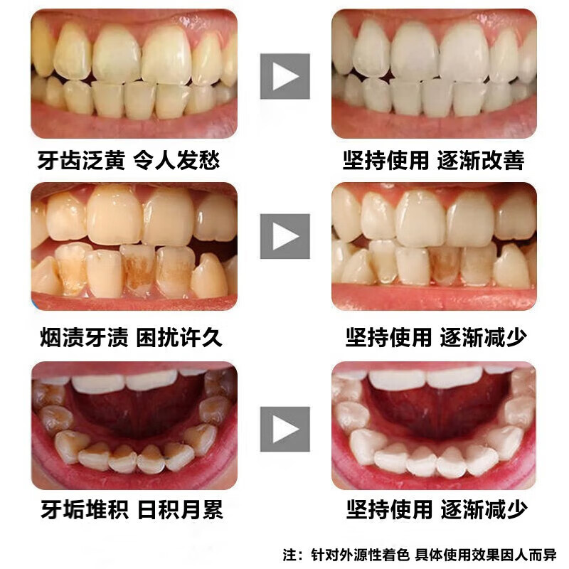 Nanjing Tong Ren Tang Baking Soda Whitening Toothpaste Removes Bad Breath, Removes Yellow Teeth Stains, Smoke Stains, Tartar and Stone, Oral Cleansing and Fresh Breath. Old Customer Repurchase Pack 180g*3 Boxes