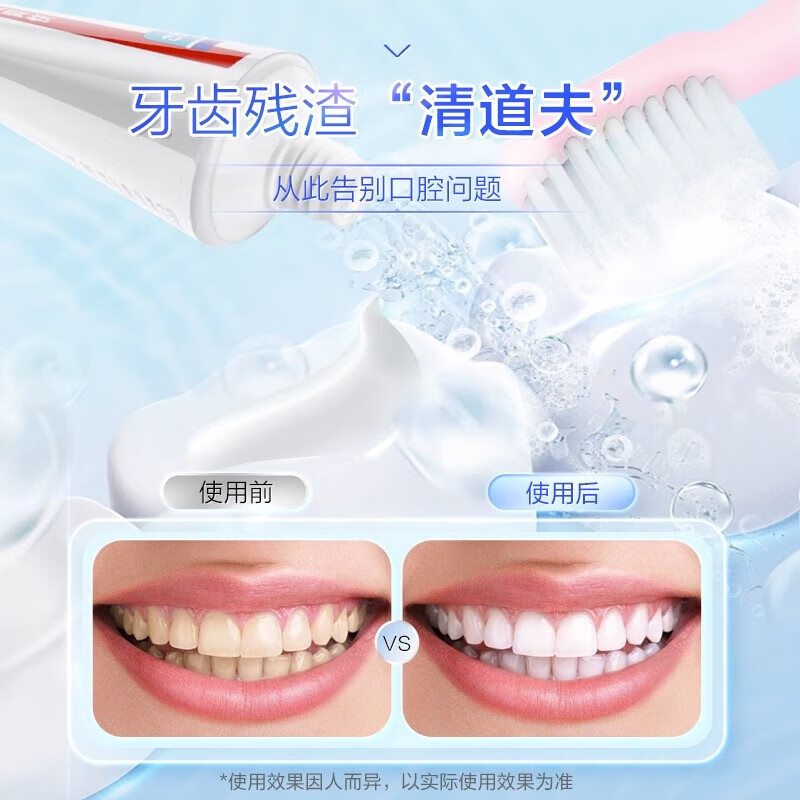 Kao (KAO) toothpaste 165g*3 classic large white toothpaste fresh breath, anti-cavity, solid tooth stain removal, original imported