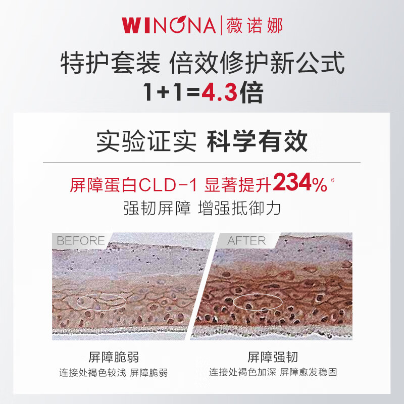 Winona Special Care Essence Set Special Care Cream Essence Lotion Face Cream Facial Skin Care Products Valentine's Day