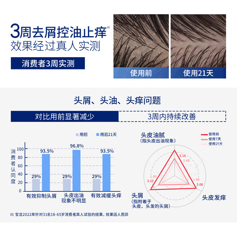 Head and Shoulders specializes in anti-dandruff and oil-control shampoo 300g patented formula oil-control shampoo for men and women, same style as Liu Yuning