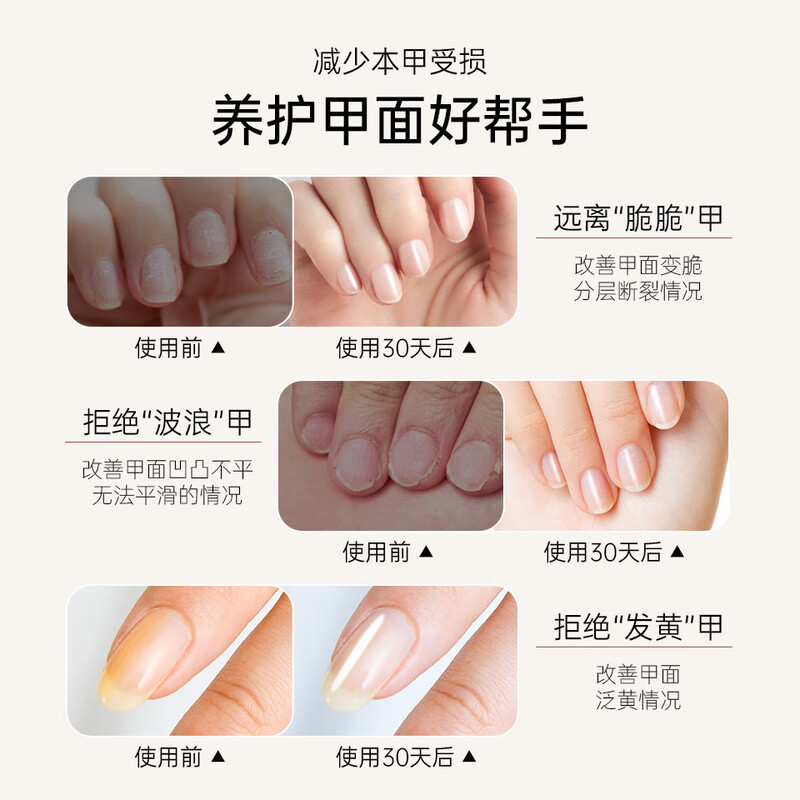 Sweet Color nail polish plus calcium base oil transparent bright nail functional oil nutritional nail oil anti-breakage armor New Year gift