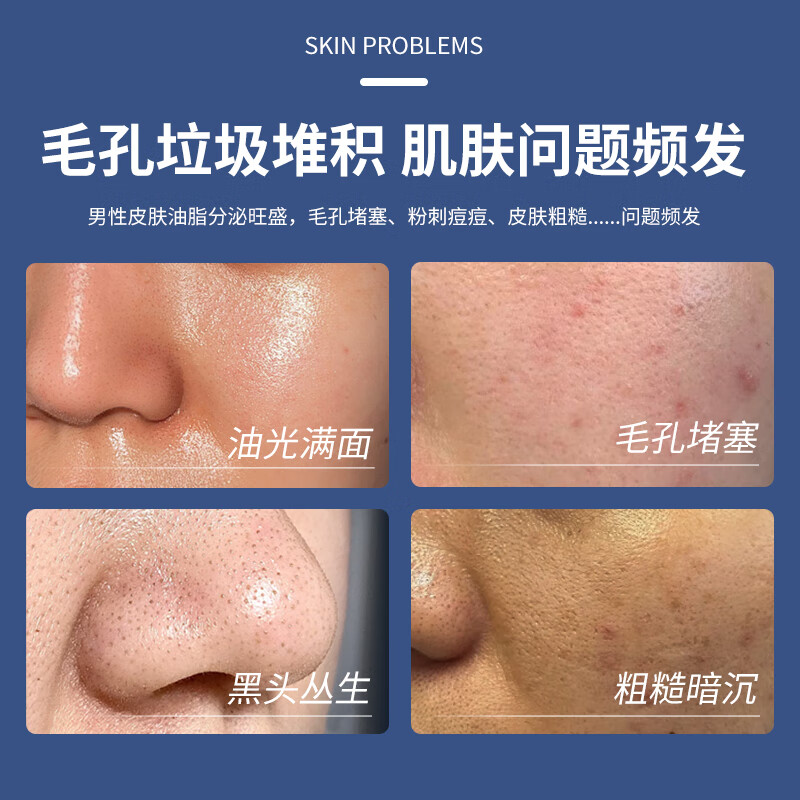 Hongwei volcanic mud suet soap 120g*2 three-in-one soap for washing face, bathing and washing hands, oil control cleansing soap