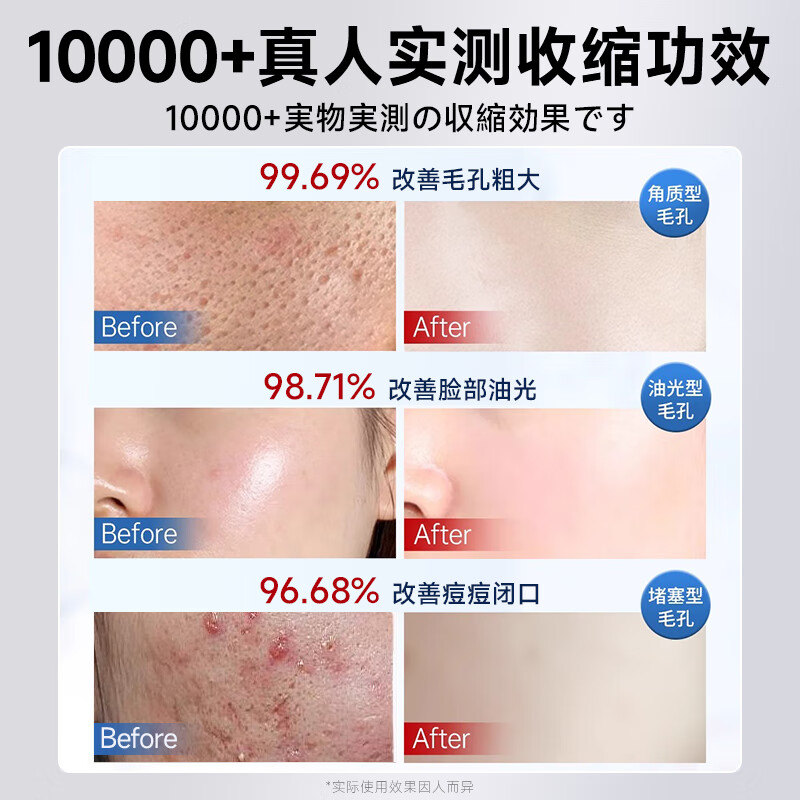 Dr. Jiao's Japanese pore shrinking mask, thick repairing, meticulous oil control, acne removal, salicylic acid acne mark removal mask for women and men