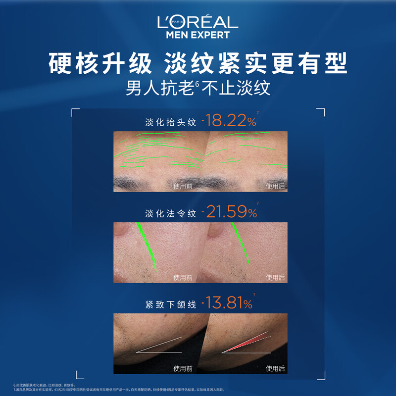 L'Oreal Men's Youth Muscle Source Lightening Cream 50ml Anti-wrinkle Firming Skin Care Products for Autumn and Winter New Year's Gift for Boys