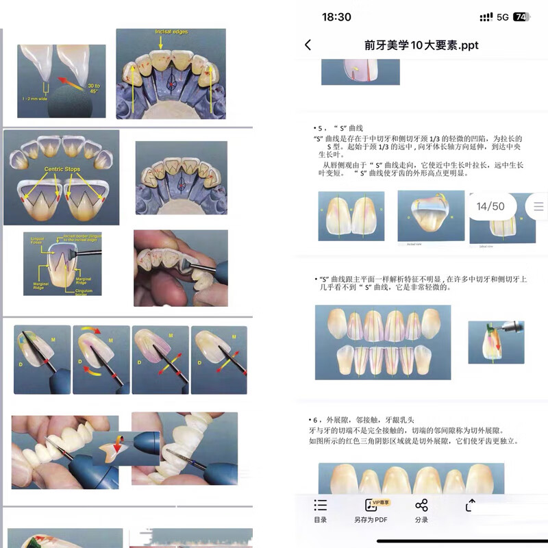 Turning porcelain, dentures, morphological aesthetics, 2025 latest technical information with detailed steps, take a photo and send the complete set of information