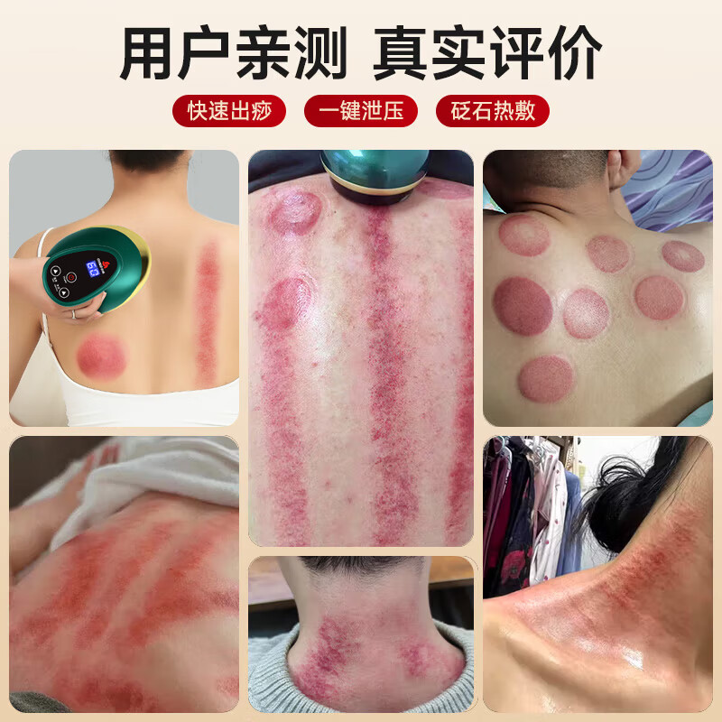 CHIGO Gua Sha instrument, electric scraping instrument, cupping device, hot compress and massage all-in-one household artifact, negative pressure for waist, legs and back, whole body meridians dredging, board brush to remove moisture, practical Chinese Valentine's Day gift, green charging model, magnetic bead travel tank + red light hot compress + 9-level regulation + gift box packaging, birthday gift for parents, elders, holiday high-end household gift
