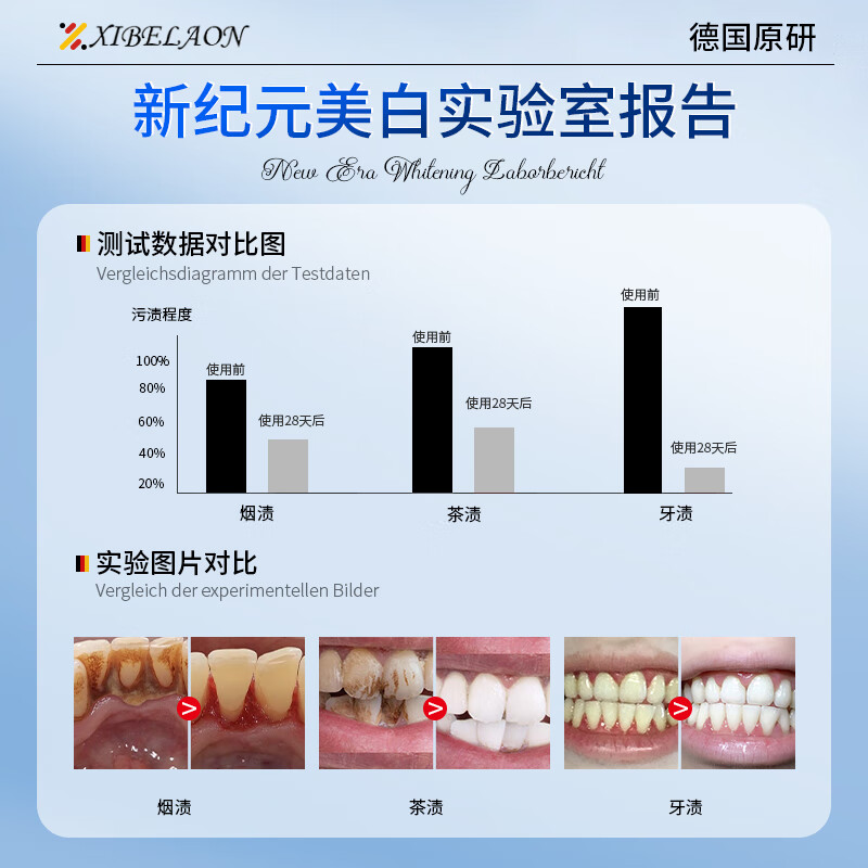 XIBELAON German brand whitening toothpaste removes yellowing, stains, inhibits bacteria, removes bad breath and stones, top ten well-known brands, contains fluoride and protects gums
