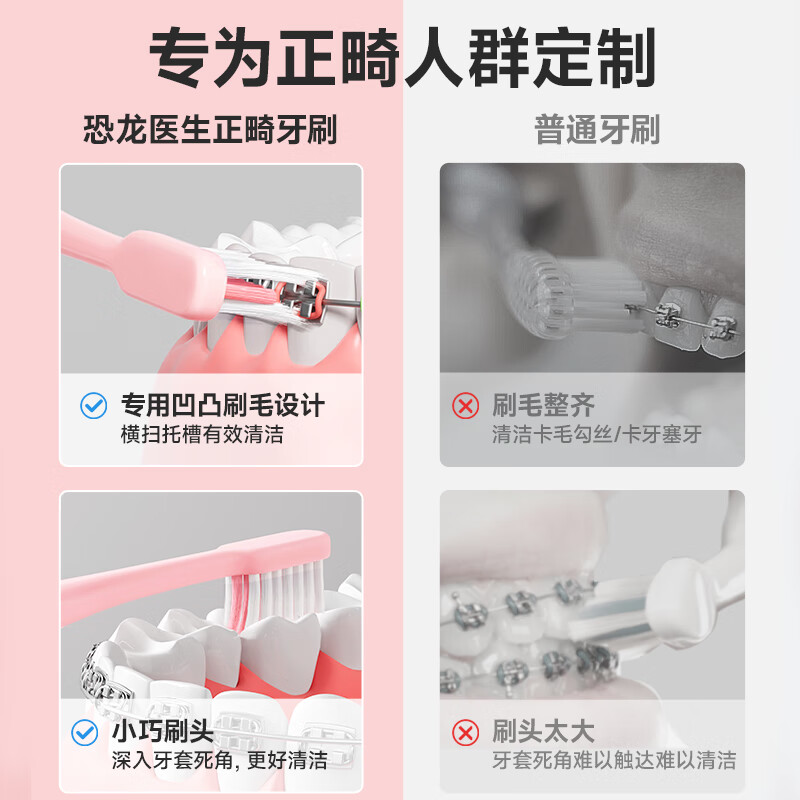 Dinosaur Doctor (PROTEFIX) Orthodontic Concave Toothbrush, 4 Adult and Adolescent Toothbrushes, Soft-bristled Portable Interdental Brush (Blue*2+Pink*2)