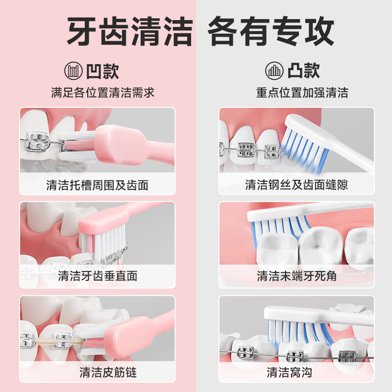 Dinosaur Doctor (PROTEFIX) Orthodontic Concave Toothbrush, 4 Adult and Adolescent Toothbrushes, Soft-bristled Portable Interdental Brush (Blue*2+Pink*2)