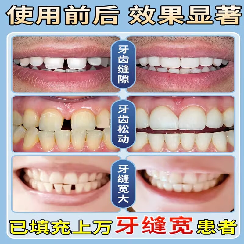 Gap i wide auxiliary repair artifact gap filling repair gap care toothpaste one box trial pack