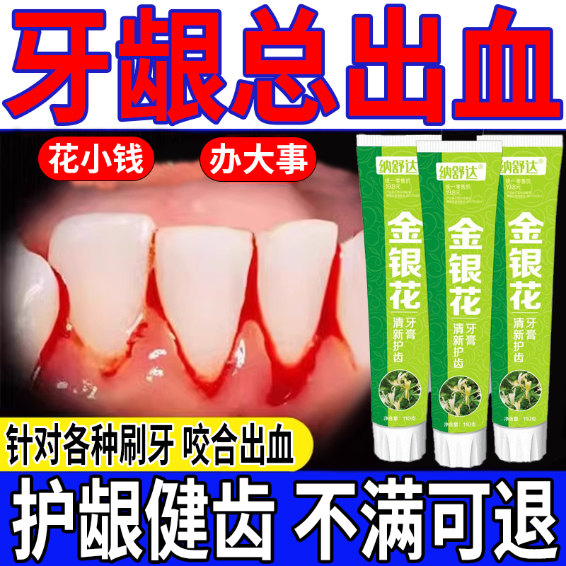 Special toothpaste for sensitive teeth, swollen, painful gums and bleeding gums. Special toothpaste for tooth pain, anti-inflammation, sterilization, swelling, pain relief, and bad breath removal. Two packs. Big discount.