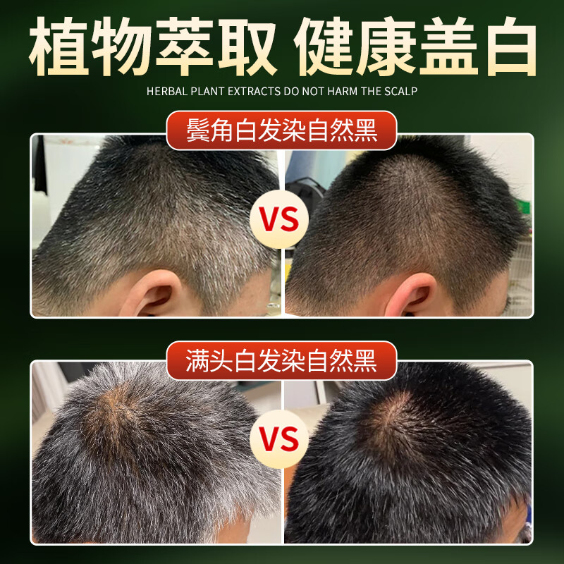 Qiao Chong One Wash Black Hair Dye, pure natural plant, non-irritating, does not stick to the scalp, genuine hair dye cream, natural black covering white hair