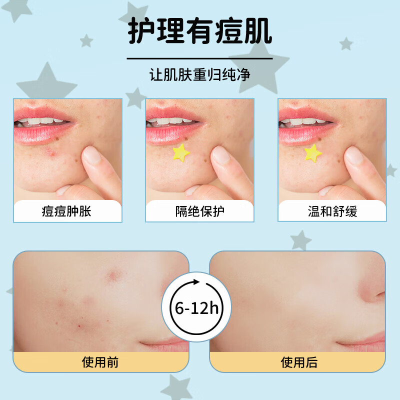 AUSLKA Beauty Yellow and Blue Star Acne Patch physically absorbs pus, is gentle and non-irritating, and is lightweight and breathable. Mirror box for day and night use.