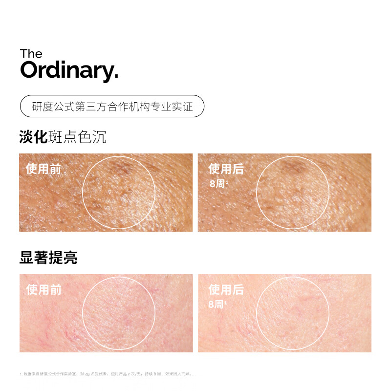 THE ORDINARY2% Arbutin Hyaluronic Acid Essence 30ml Brightening, Hydrating and Brightening Essence Beauty Skin New Year Gift for Men and Women