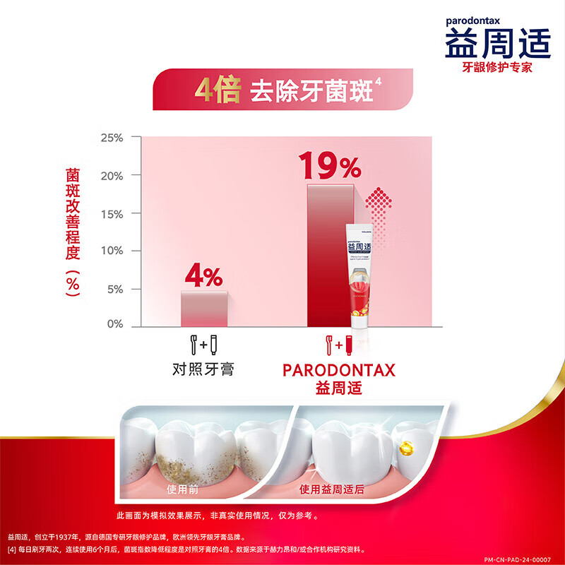 Yizhoushi special salty toothpaste for repairing gums and relieving bleeding gums, strong gum protection 165g