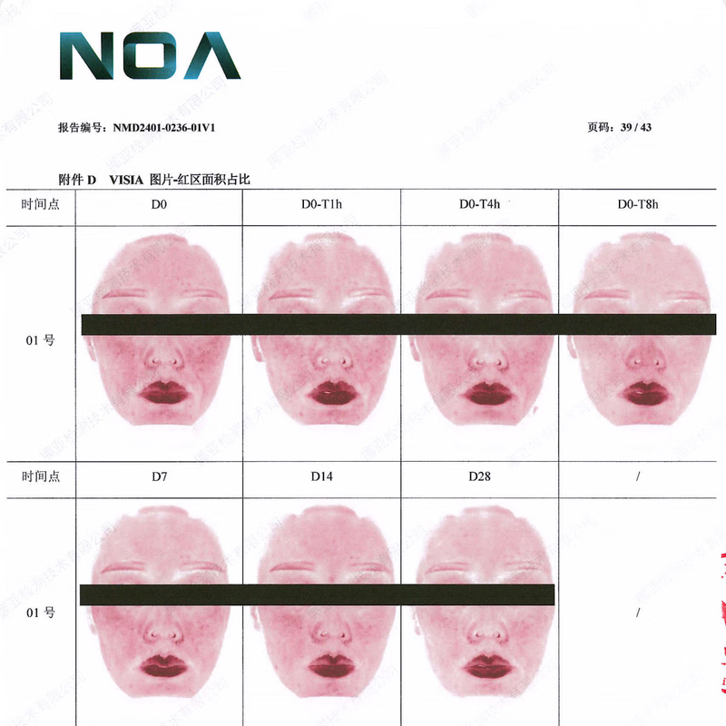 Anxiuze Color Repair Small Silver Bottle Essence 4ml Whitening and Freckle Special Treatment Repairs Light Dark Acne Marks