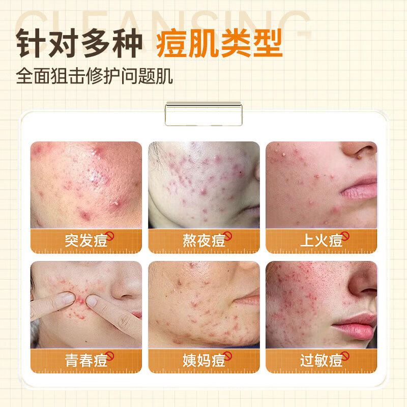 SEEDONVEUR medical research acne patch absorbs pus, invisible concealer, anti-acne, cute star acne patch, can be used for makeup, ultra-thin 160 patches