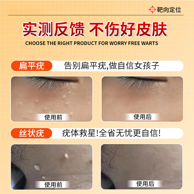 Dr. Mo's Wart Removal Soap, Wart Exfoliation Cream, Removes Warts, Filamentous Plantar Condyloma Acuminata, Removes Warts Type Warts 100g