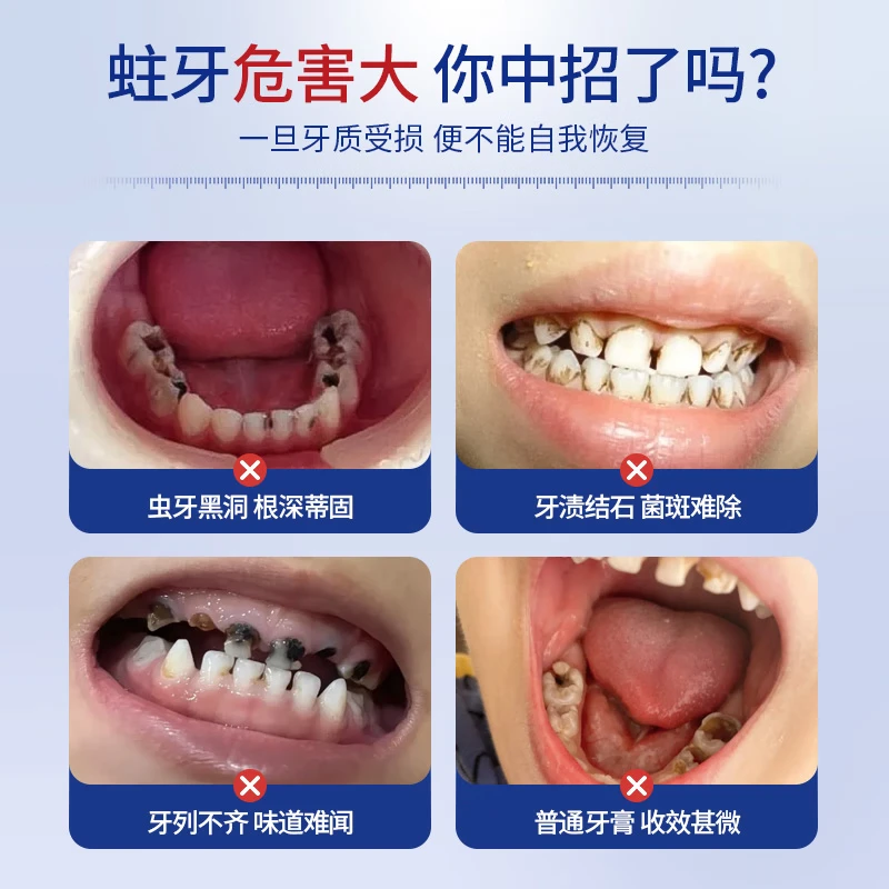 Children's toothpaste 3-12 years old containing fluoride and anti-moth children's Ora fluoride toothpaste gum care fresh breath 3 pack